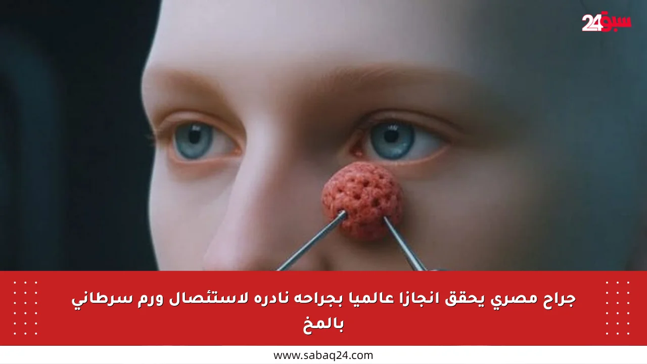 جراح مصري يحقق إنجازا عالميا بجراحة نادرة لاستئصال ورم سرطاني بالمخ